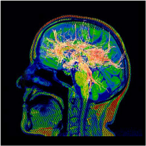 Imagerie neurologique IMFM Paris