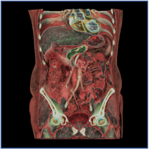 imagerie abdominale Paris