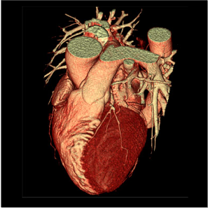 Imagerie Cardio-Vasculaire Paris