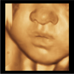 imagerie pédiatrique et prénatale Paris