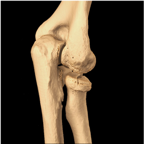 5-Osteo-articulaire-2 Imagerie Ostéo-Articulaire