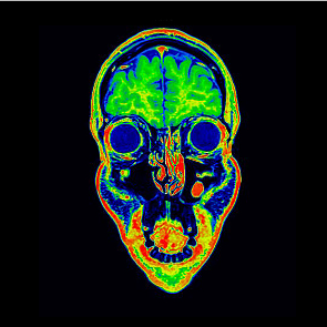 Imagerie ORL et Maxillo-Faciale Paris