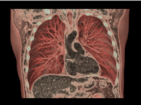 imagerie thoracique IMFM Paris